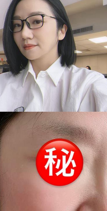陶晶瑩今早宣布「我割雙眼皮了」！「超近距離自拍」曝光全都驚呆