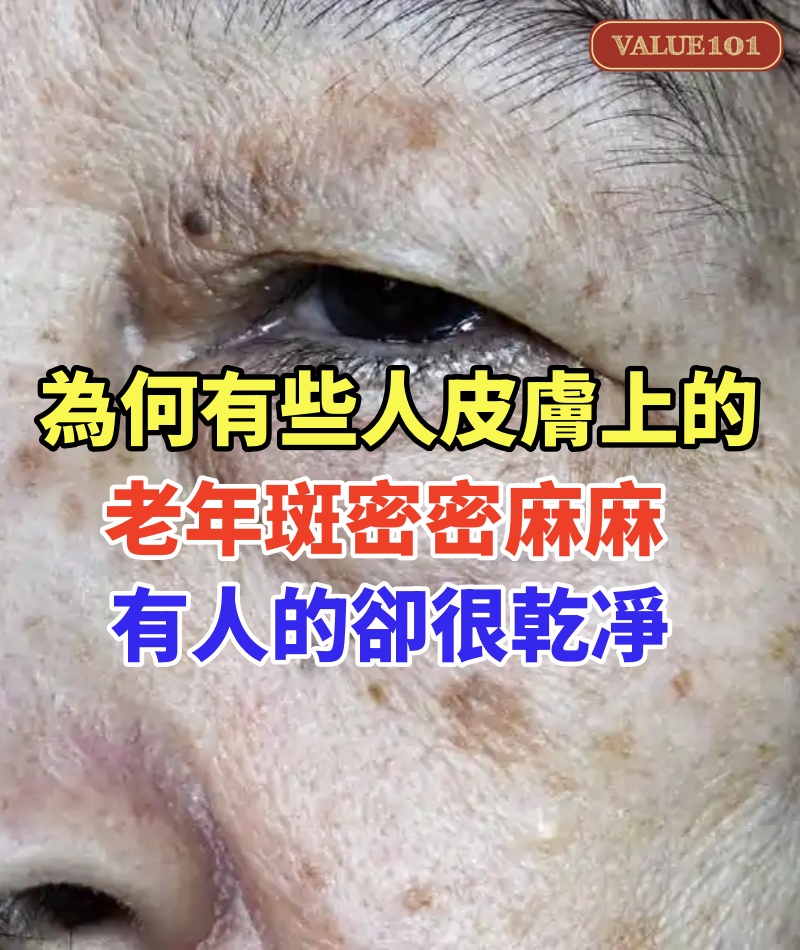 都是50歲！為何有些人皮膚上的老年斑「密密麻麻」有的卻很乾凈！醫生說出實情