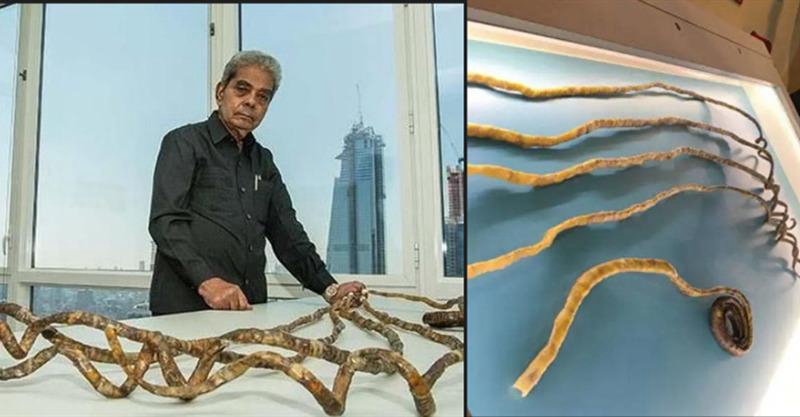 指甲留44年,印度老人忍痛剪下9公尺指甲,捐博物館手指卻突然變得不一樣了:網全傻眼